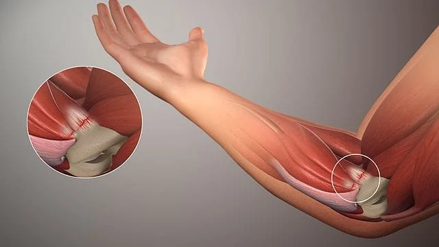 Cremas de cbd para tendinitis