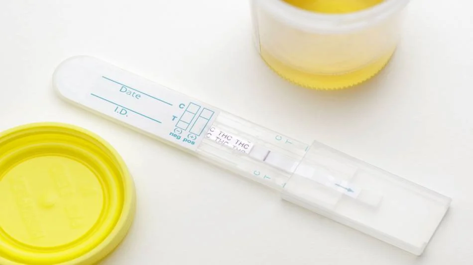 positivo el CBD en un test de drogas